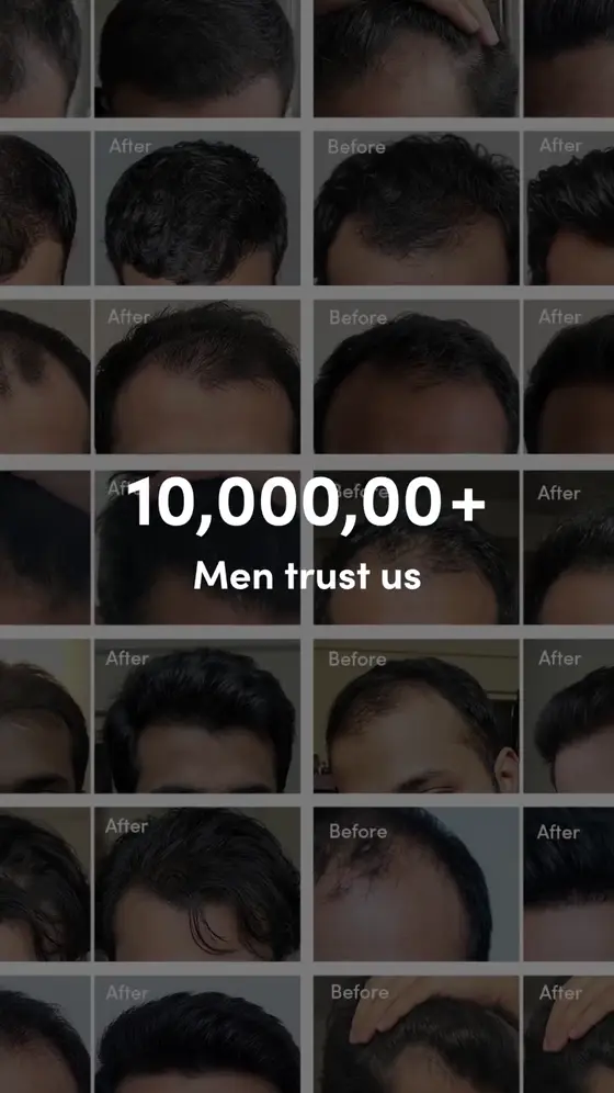 Thatdelhiigirl Before and after ad